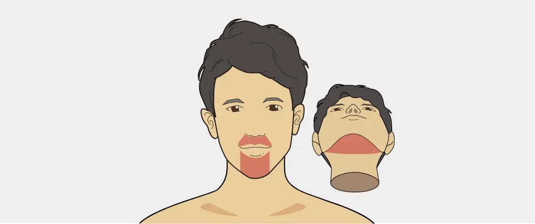 スタートプラン：ヒゲ脱毛3部位（鼻下・アゴ・アゴ下）