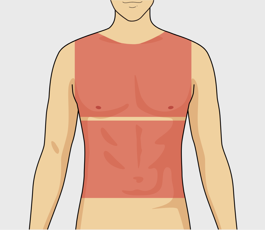 胸・腹