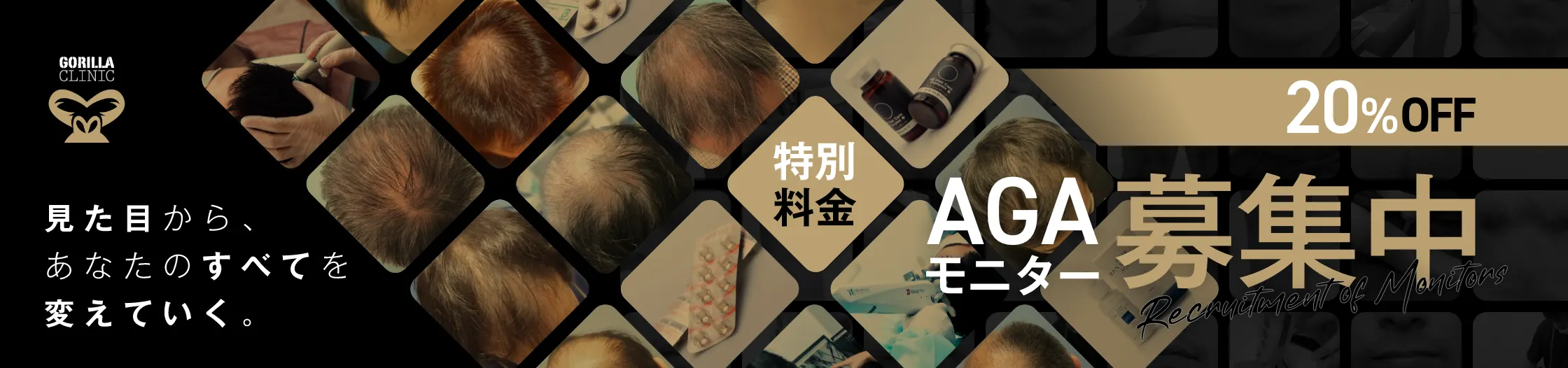 AGAモニター募集中