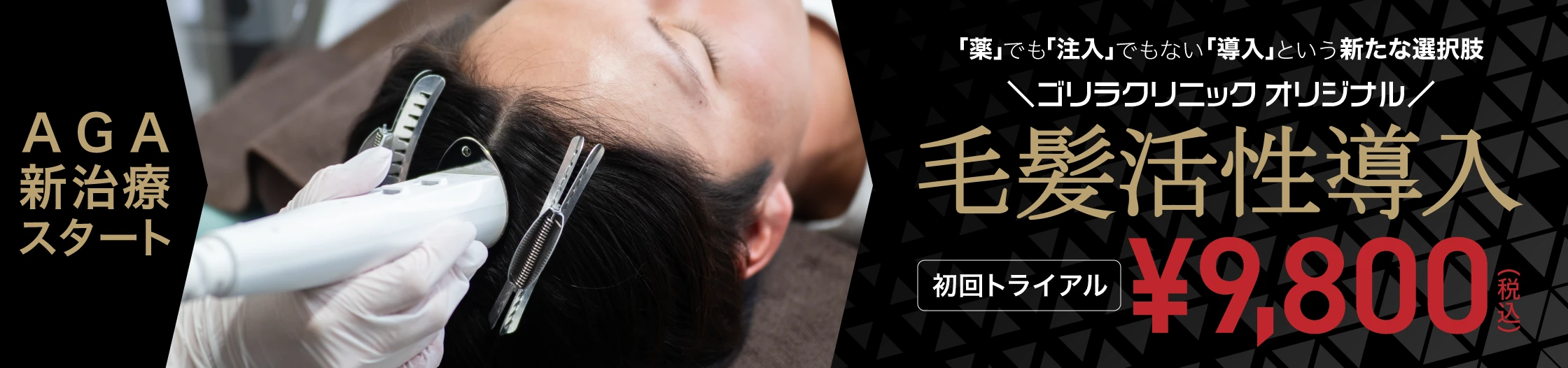 AGA治療