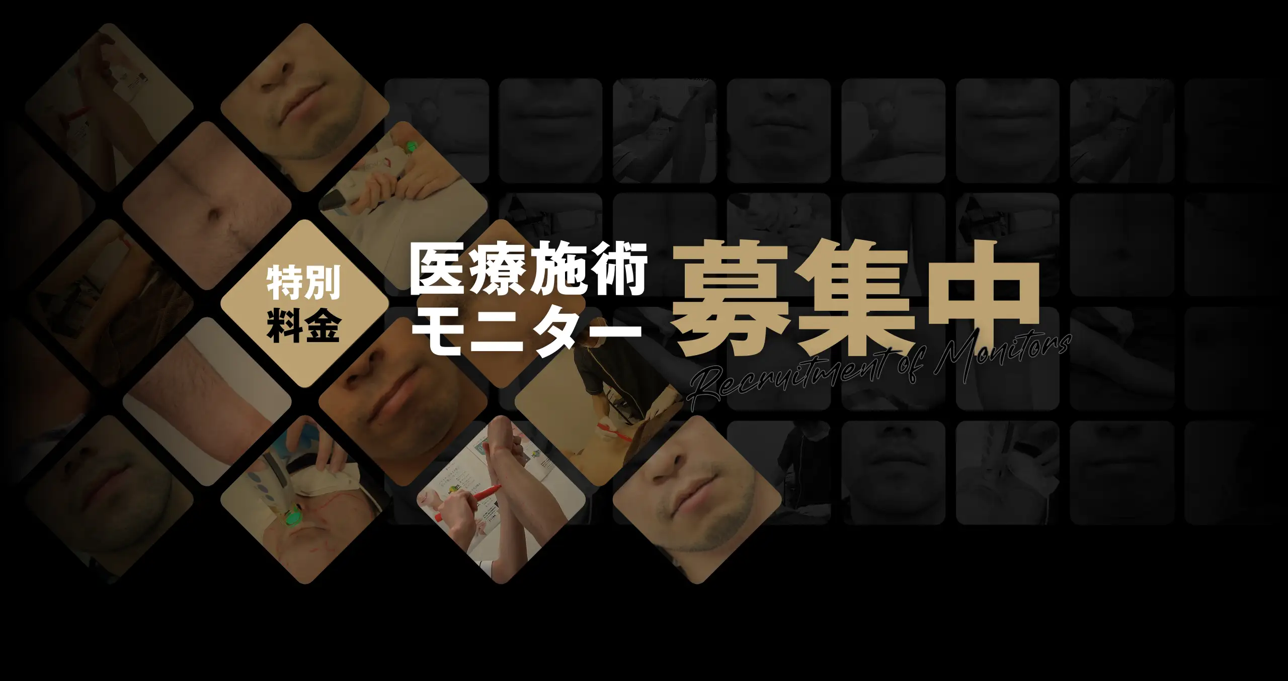 ゴリラクリニック 特別料金 医療施術モニター 募集中