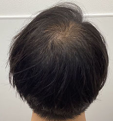 施術前