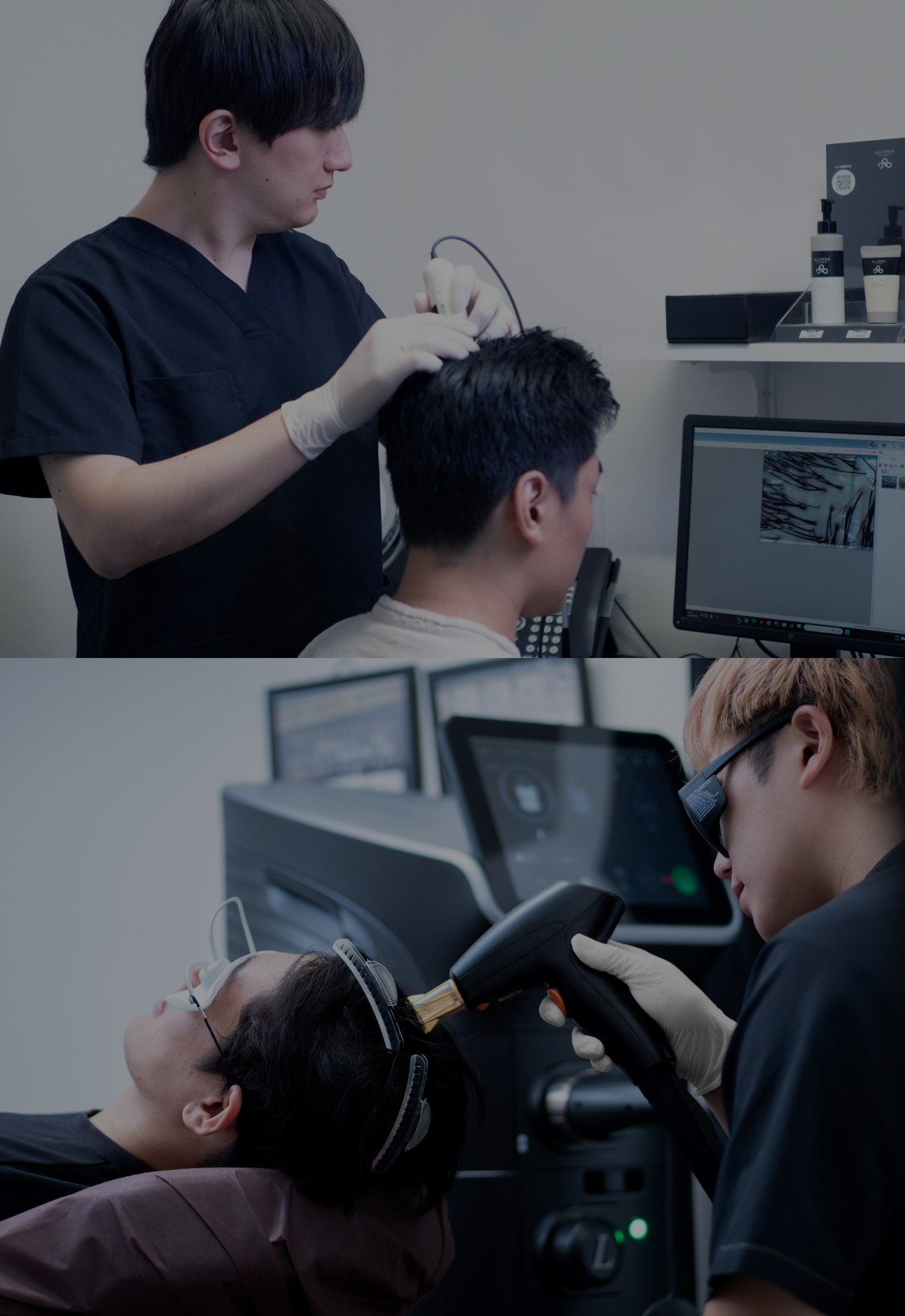 ゴリラクリニックのAGA治療