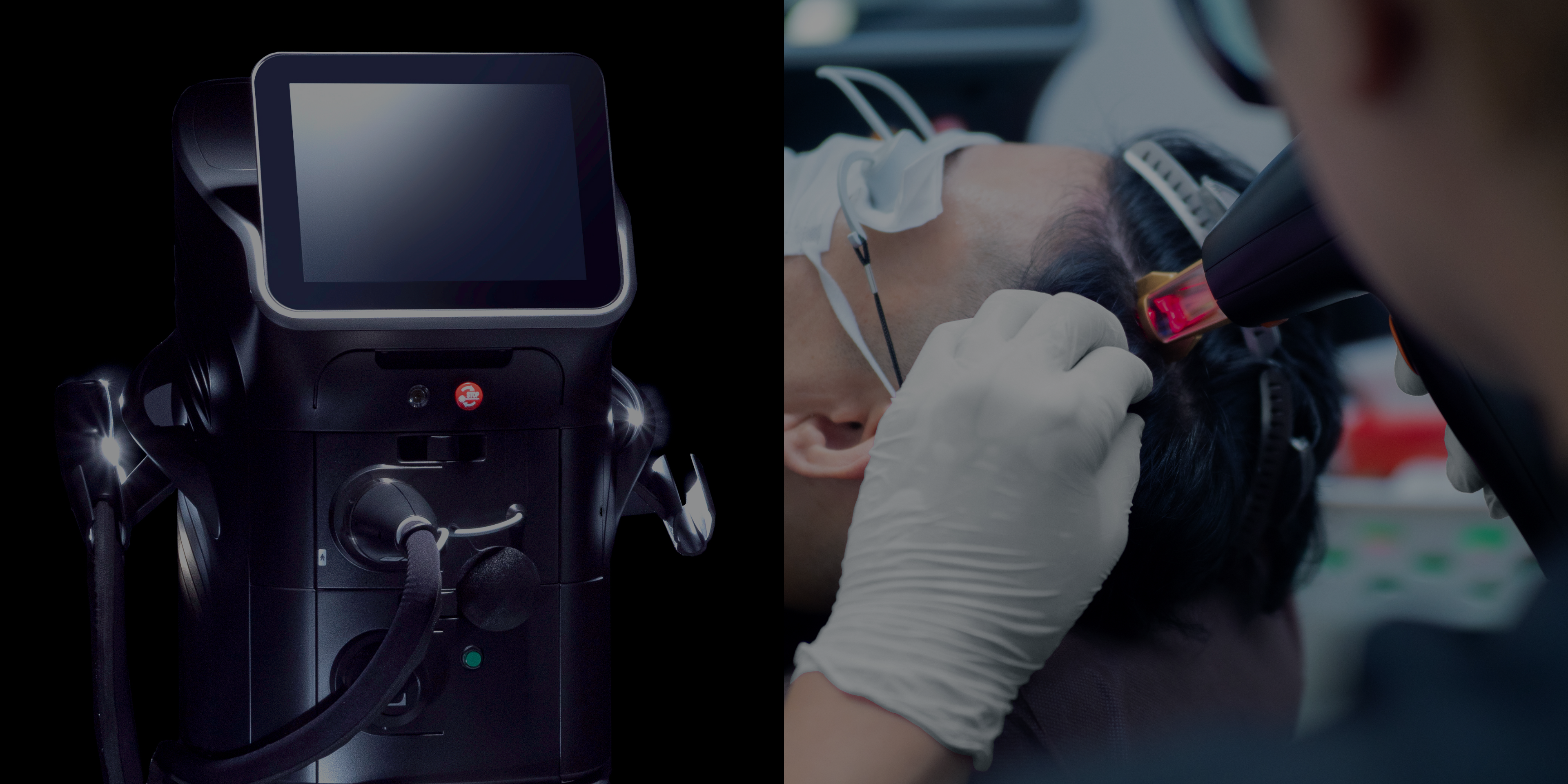 ゴリラクリニックのAGA治療