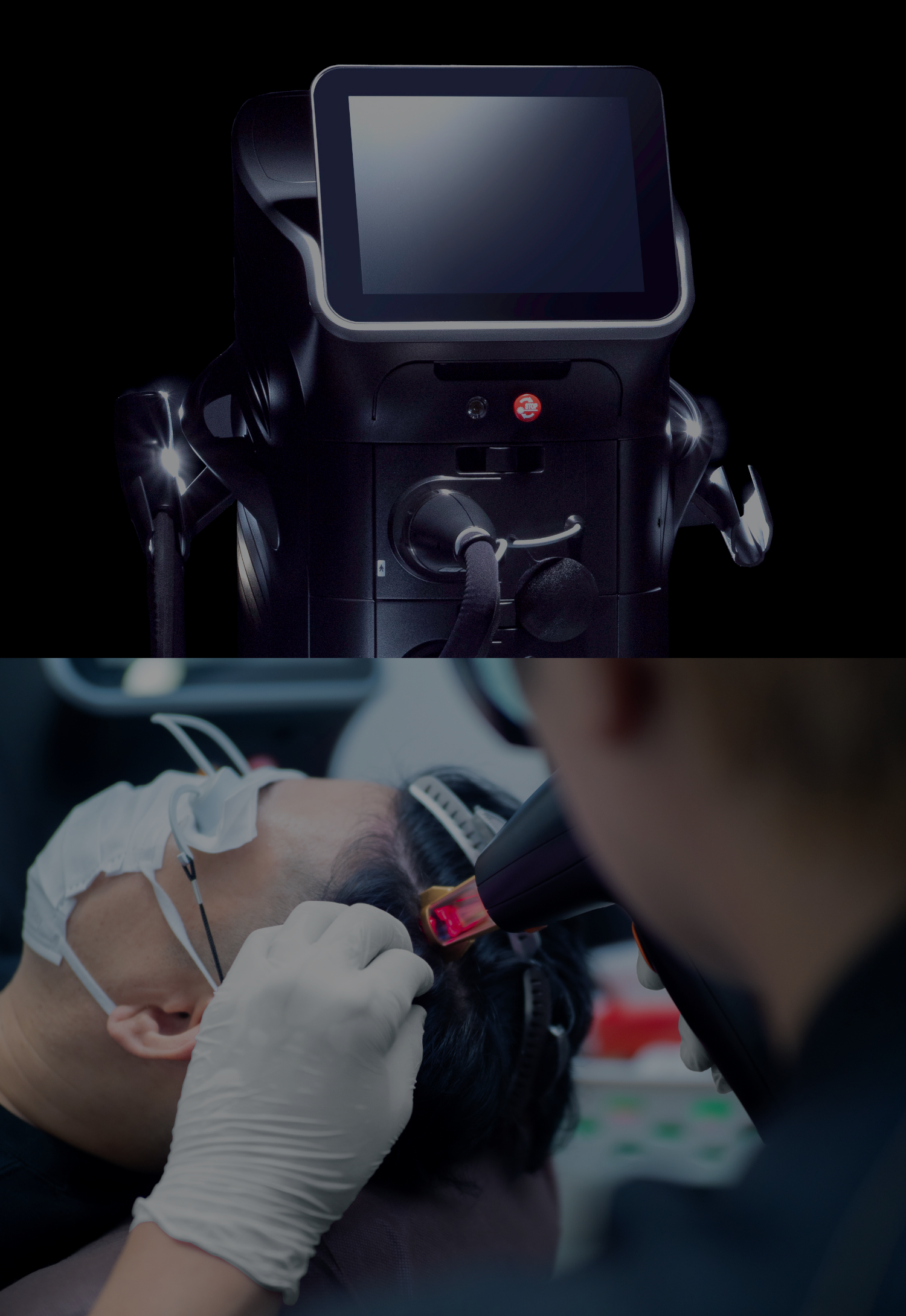 ゴリラクリニックのAGA治療