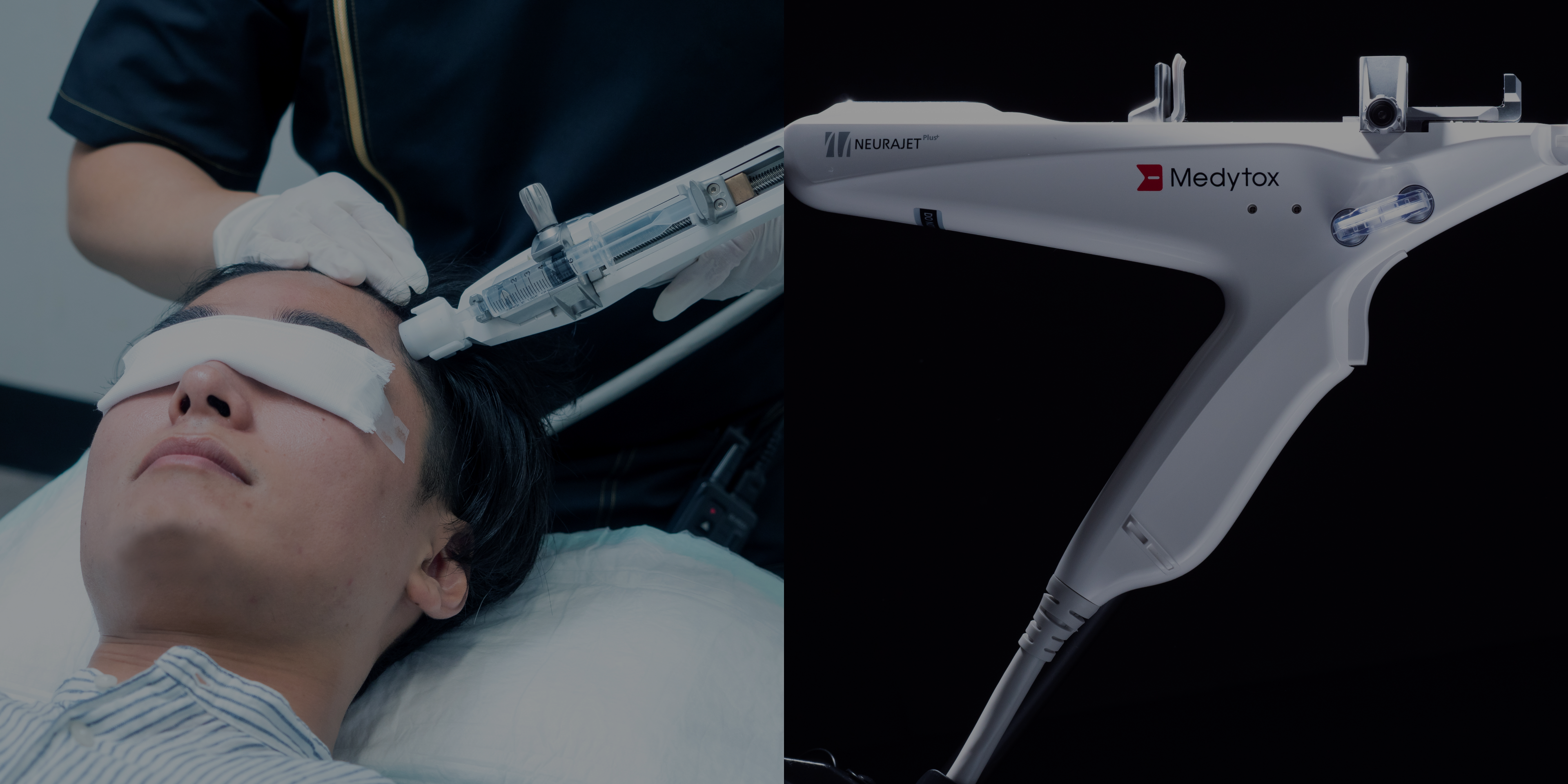 ゴリラクリニックのAGA治療