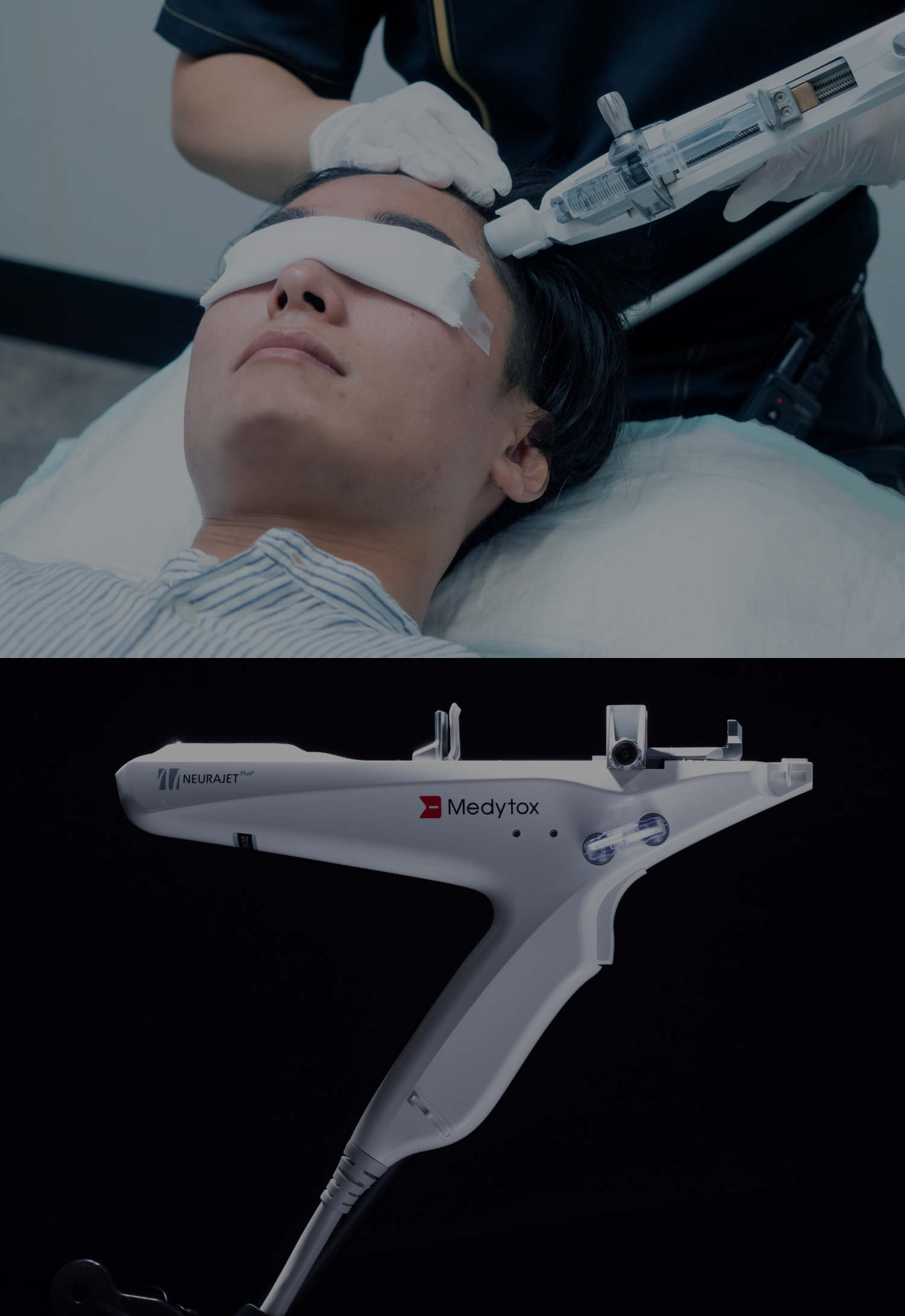 ゴリラクリニックのAGA治療