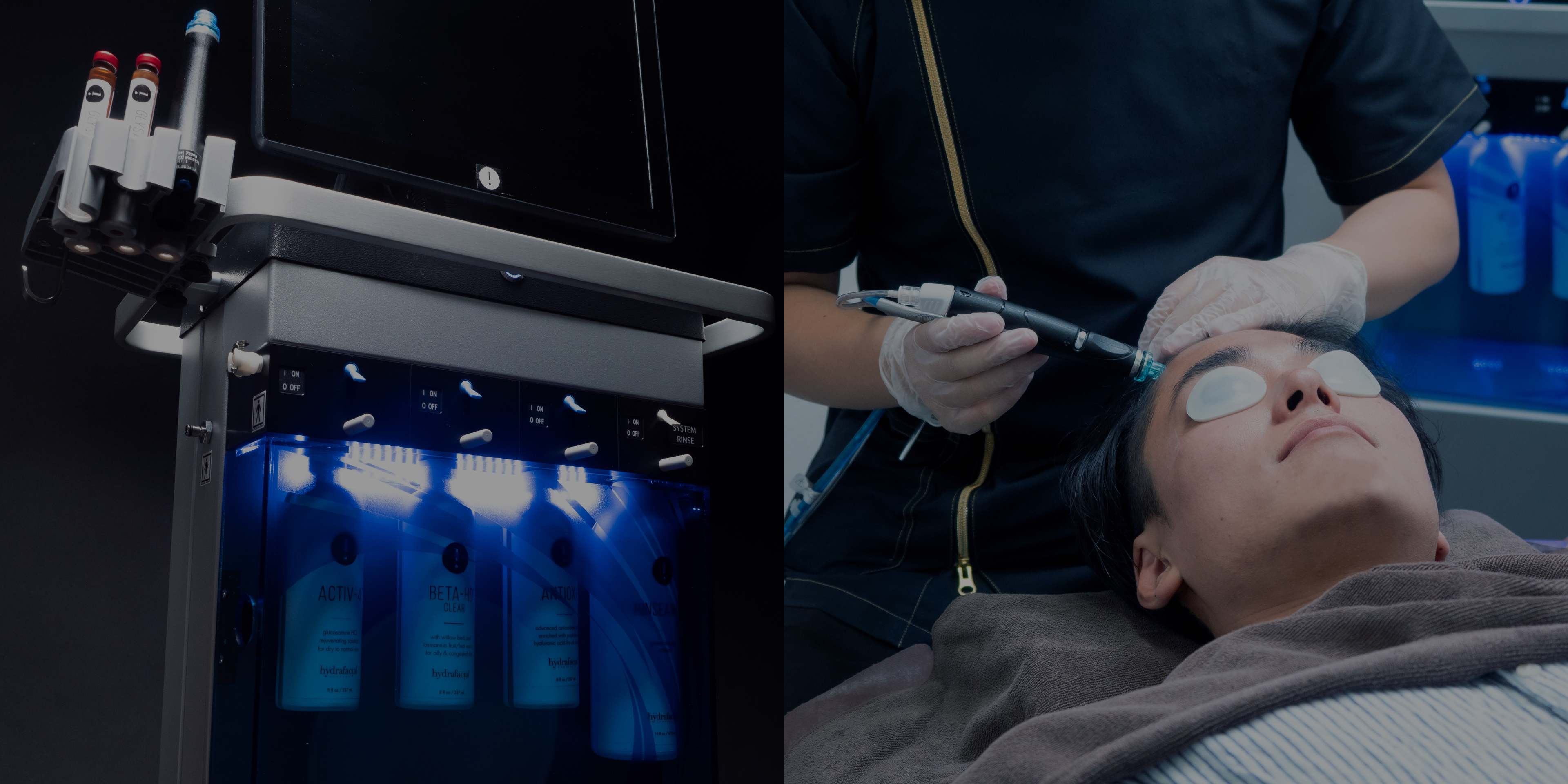 ゴリラクリニックのAGA治療