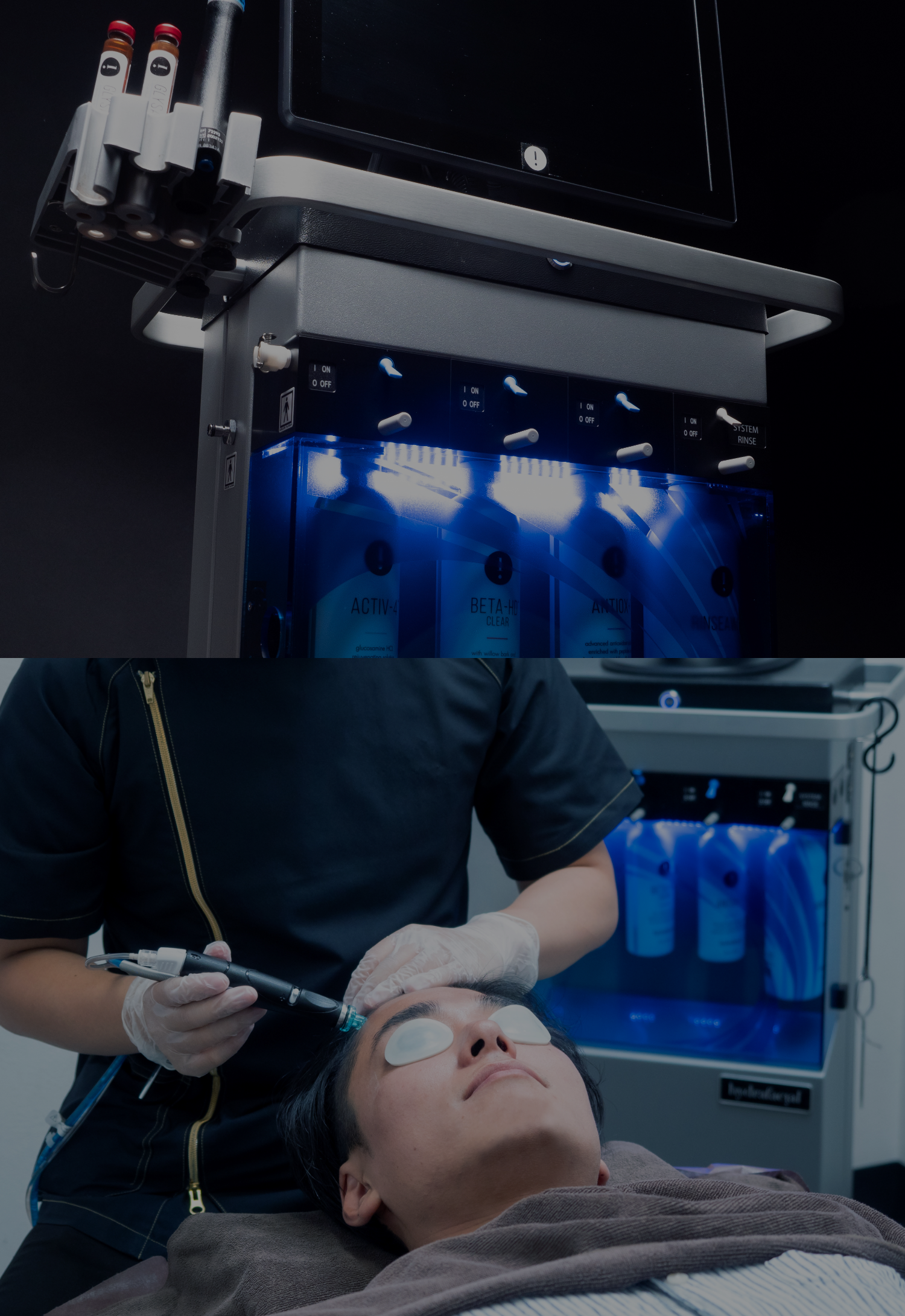 ゴリラクリニックのAGA治療