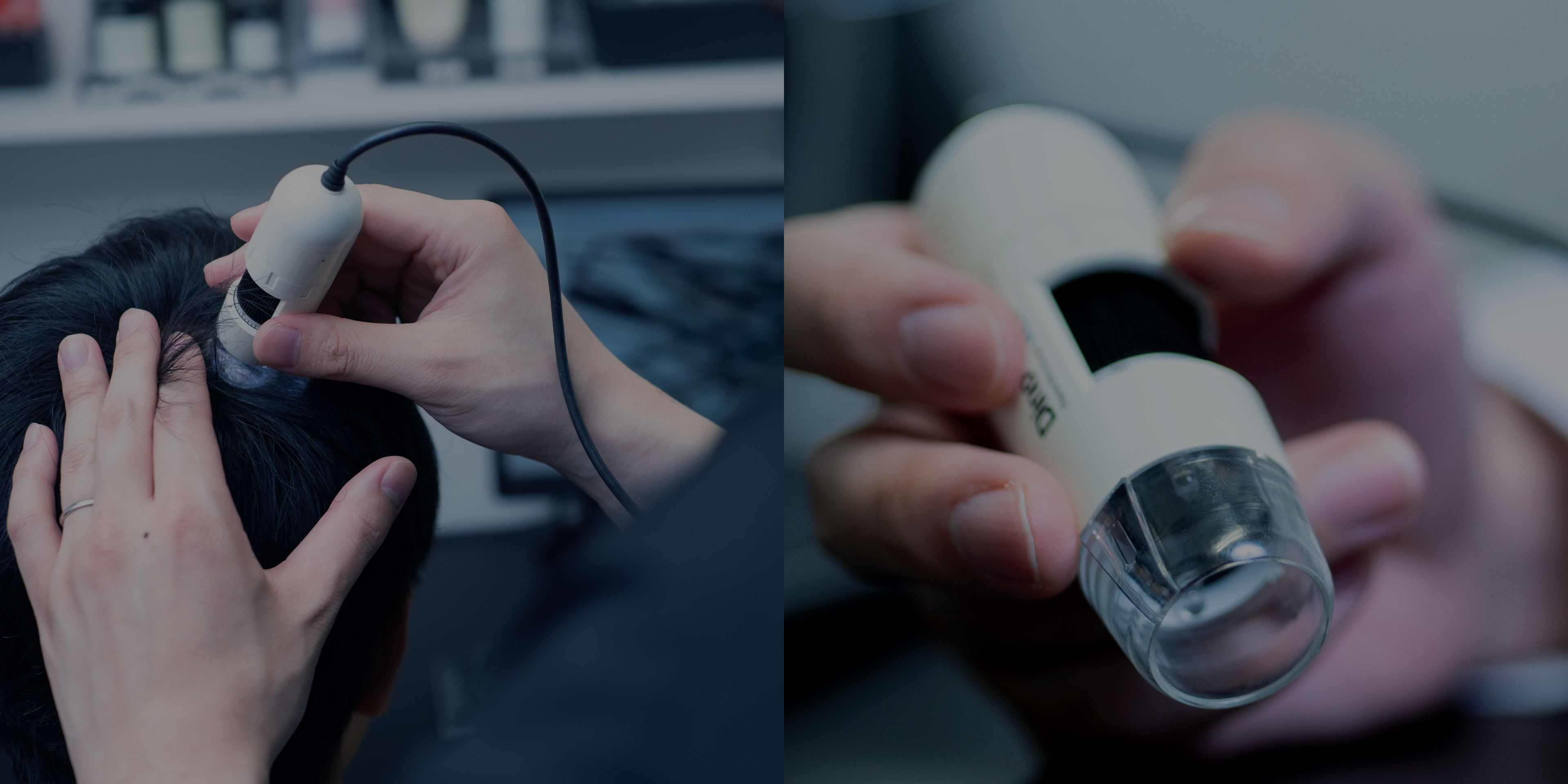 ゴリラクリニックのAGA治療