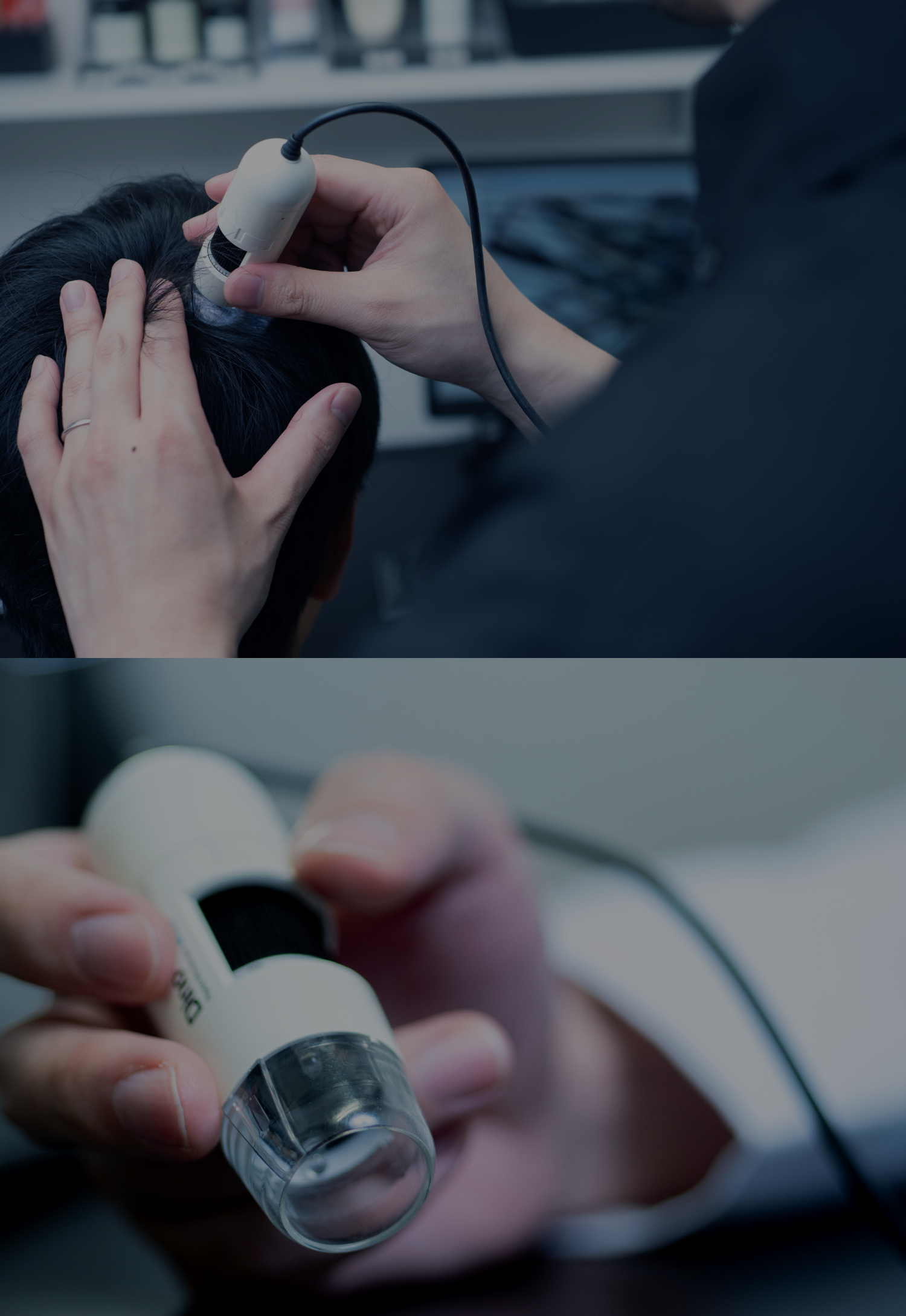 ゴリラクリニックのAGA治療