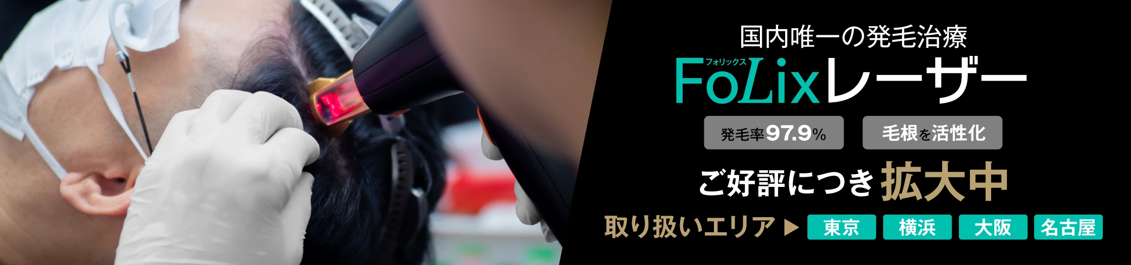 国内唯一のAGA専用レーザー治療 Folixレーザー ご好評につき増員決定