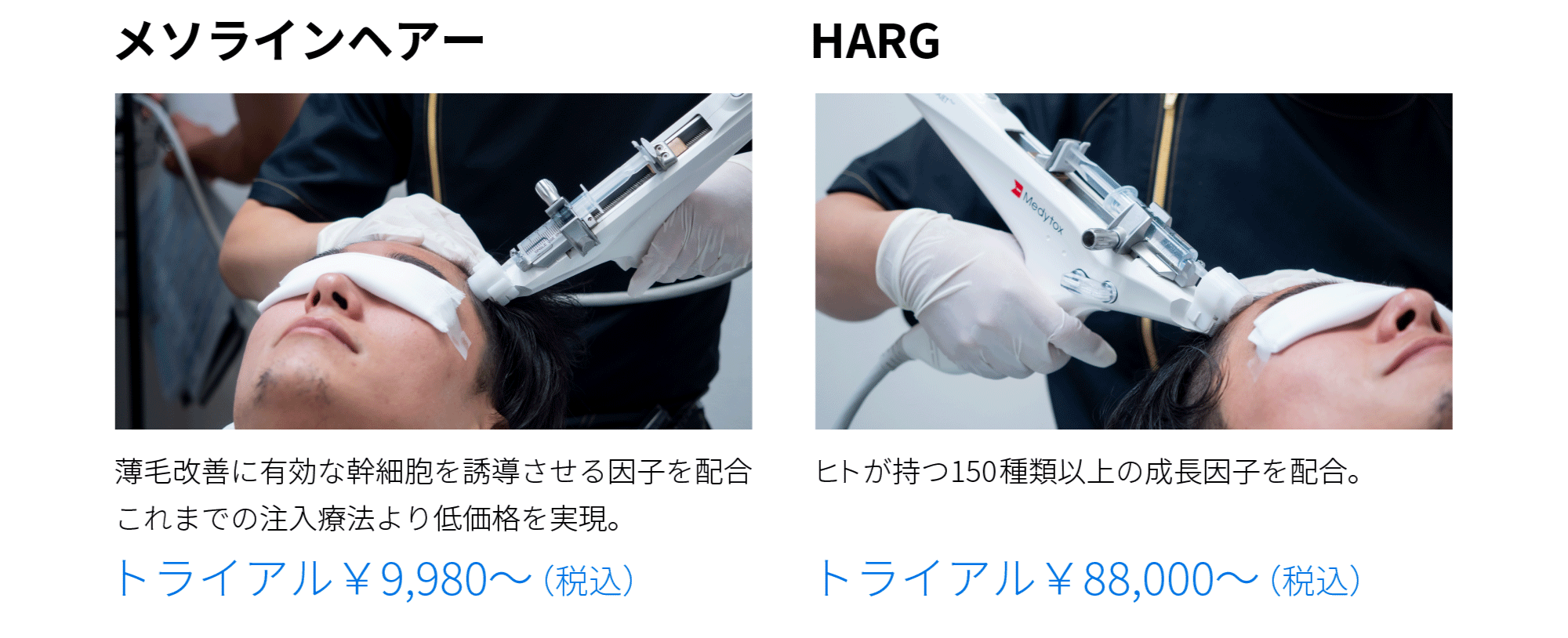 メソラインヘアーとは…