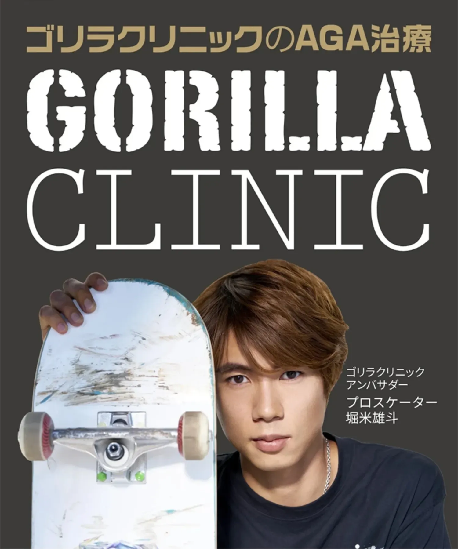 AGAならゴリラ発毛