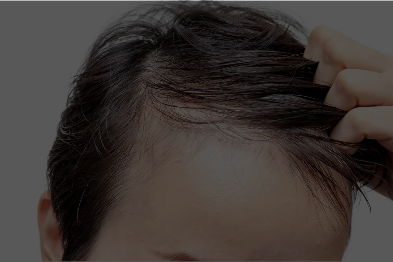 頭皮環境と毛髪の関係