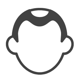 AGA（男性型脱毛症）とは？