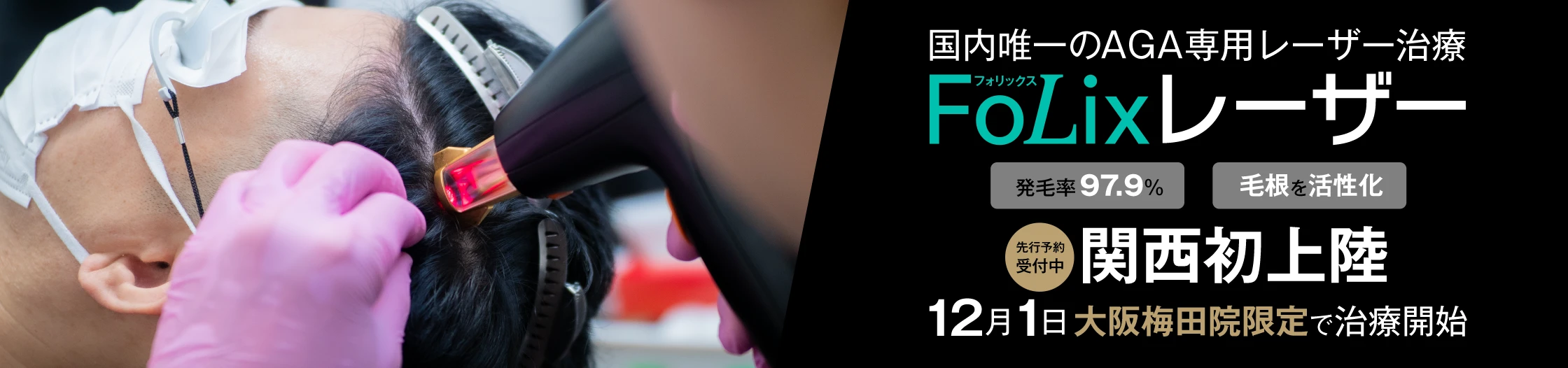 12月1日大阪梅田院限定で、国内唯一のAGA専用レーザー治療