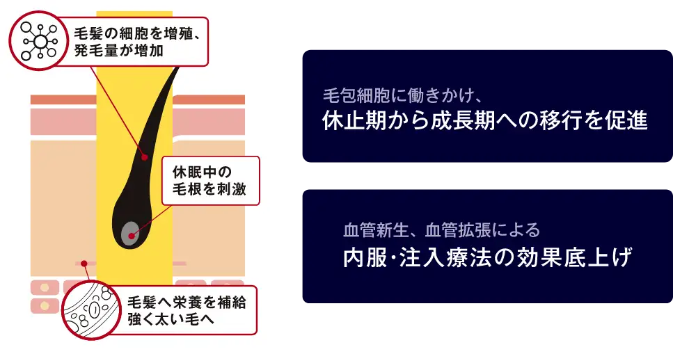 ゴリラクリニックのAGA総合治療の特徴