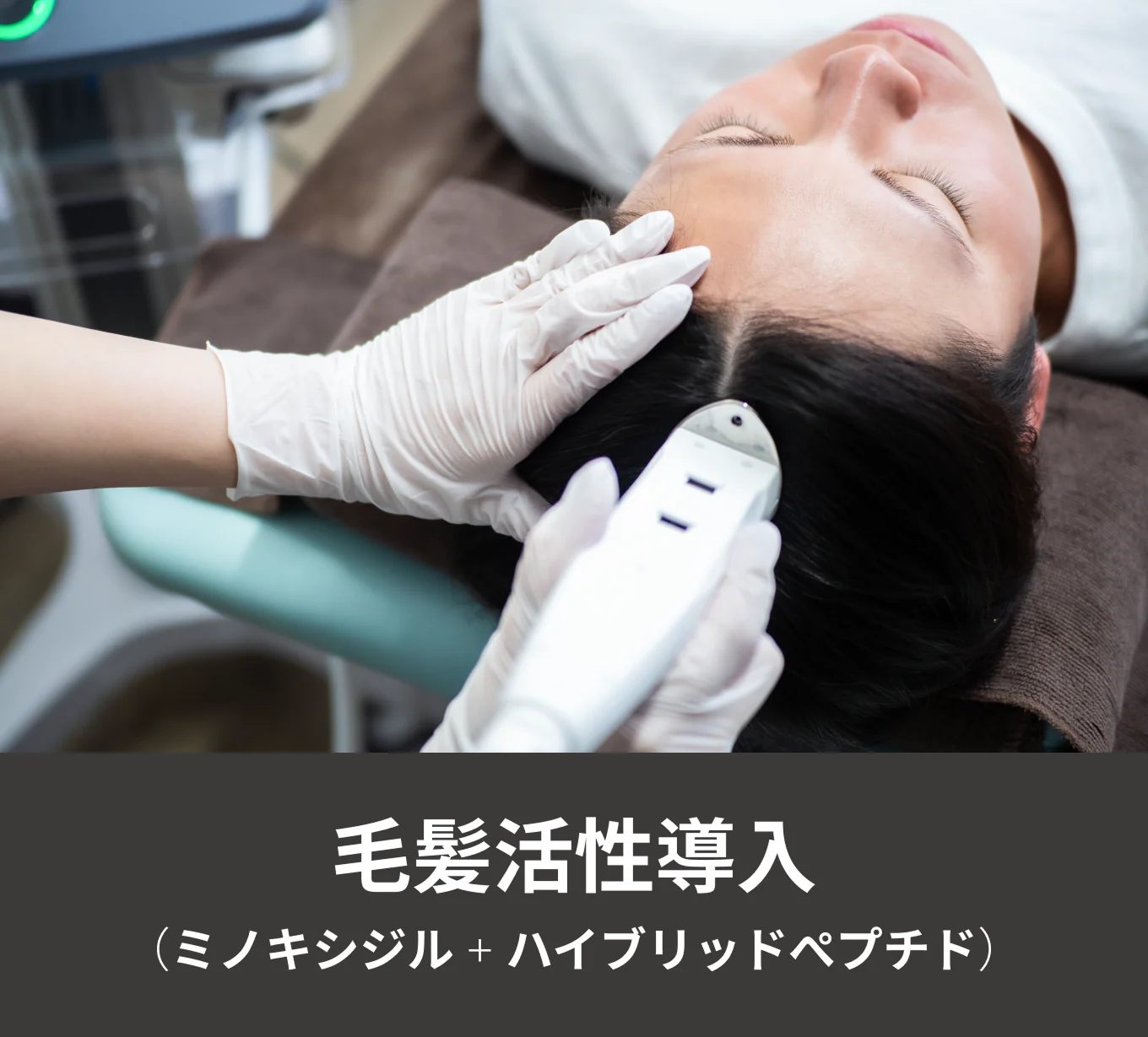 毛髪活性導入（ミノキシジル＋ハイブリッドペプチド）