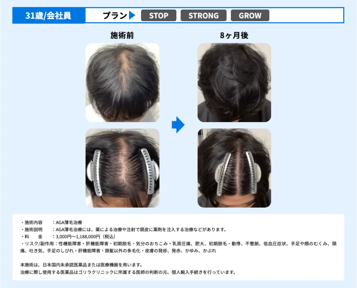 掲載例