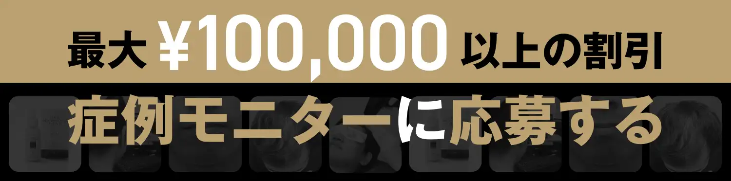 最大¥100,000以上の割引 症例モニターに応募する