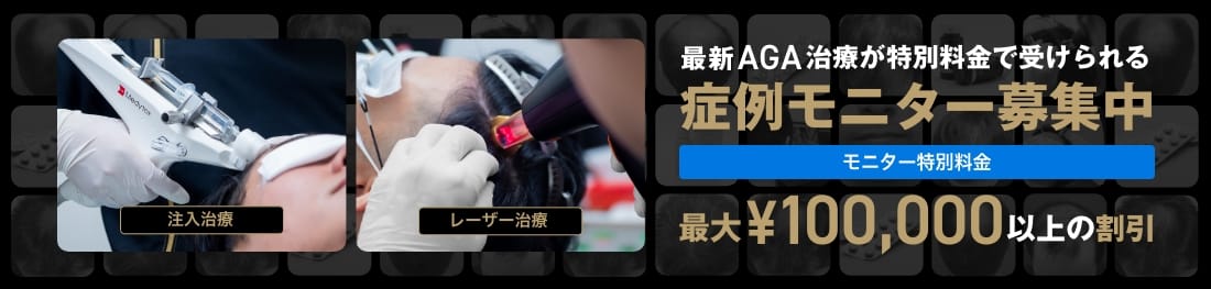 最新のAGA治療が特別料金で受けられる。症例モニター募集中。最大¥100,000以上の割引。