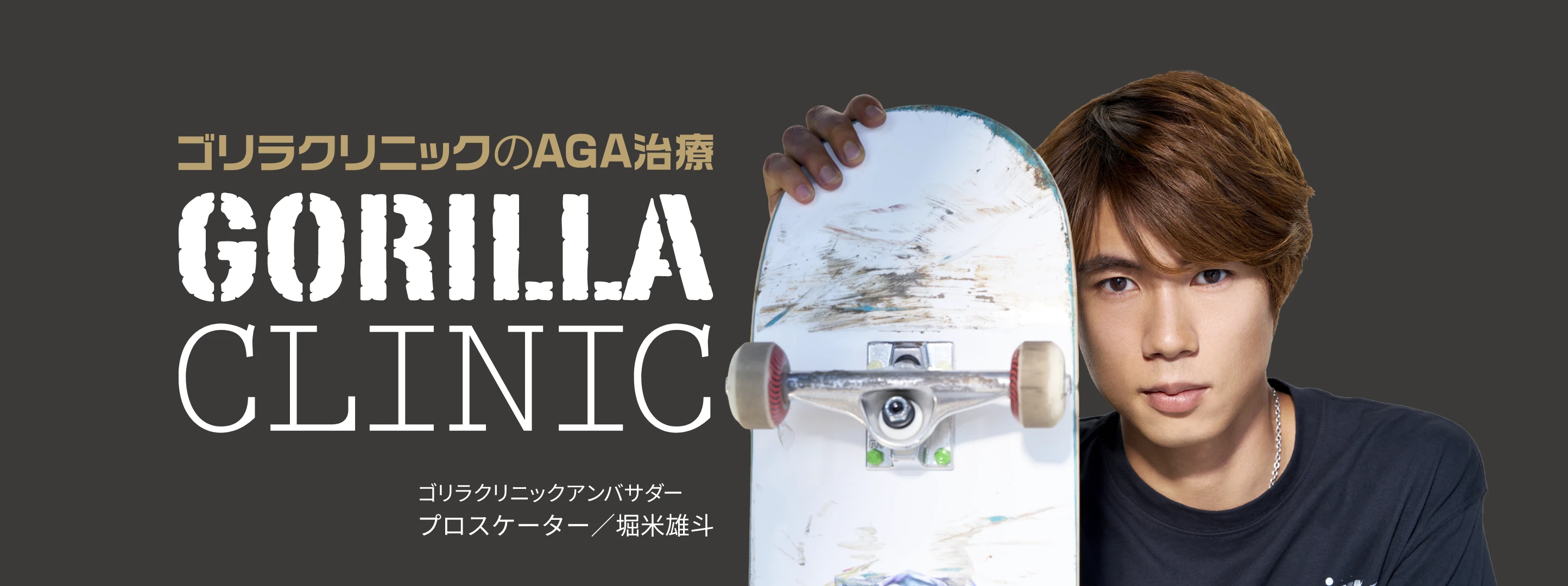 ゴリラクリニックのAGA治療