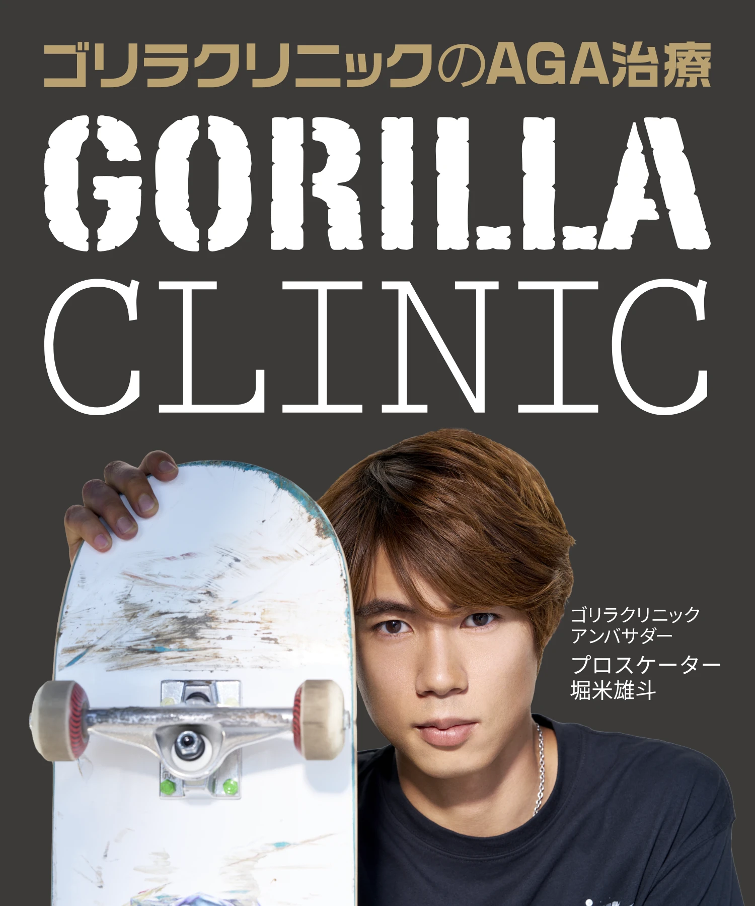 ゴリラクリニックのAGA治療