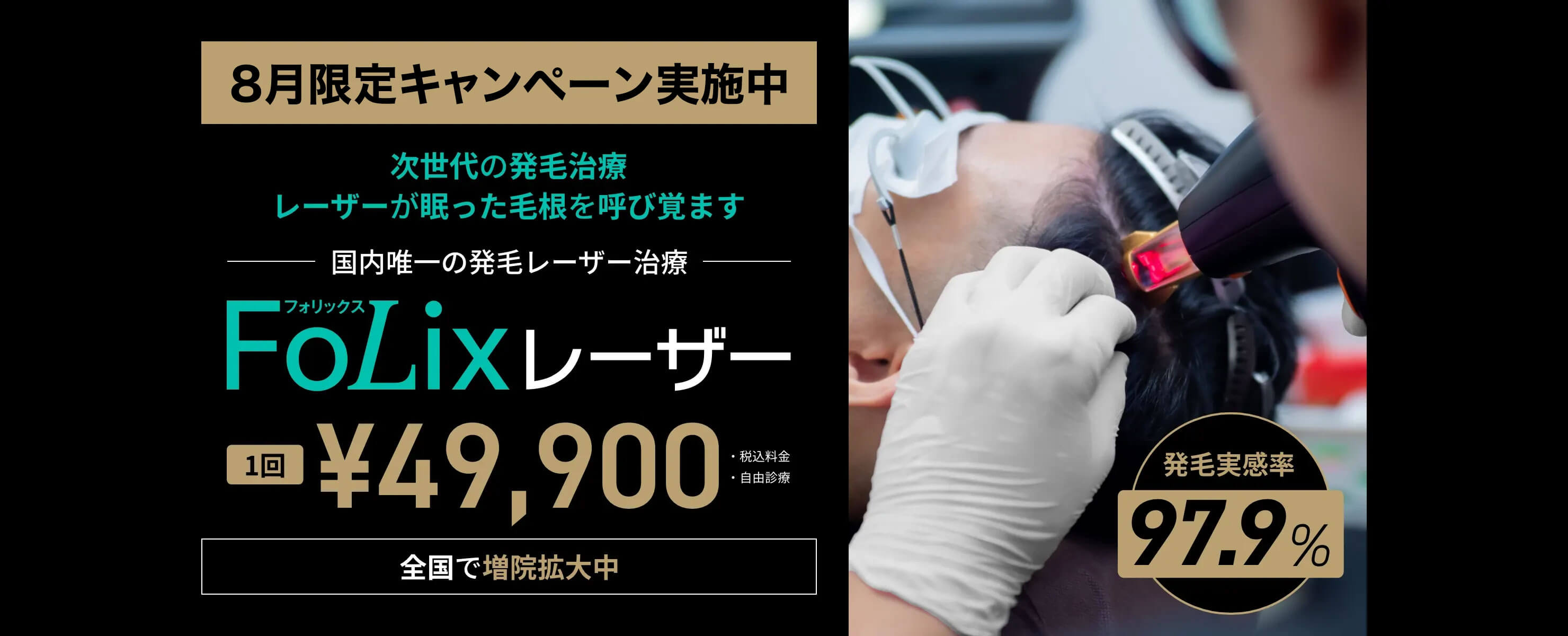 次世代の発毛治療 レーザーが眠った毛根を呼び覚ます 国内唯一の発毛レーザー治療 FoLixレーザー 1回¥49,900 発毛実感率97.9%