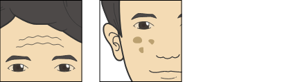 肌トラブル画像