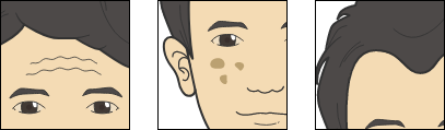 肌トラブル画像