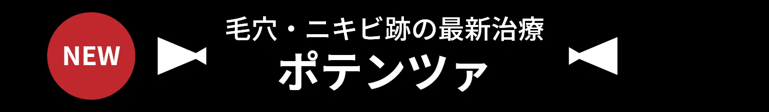 毛穴・ニキビ跡の最新治療 ポテンツァ