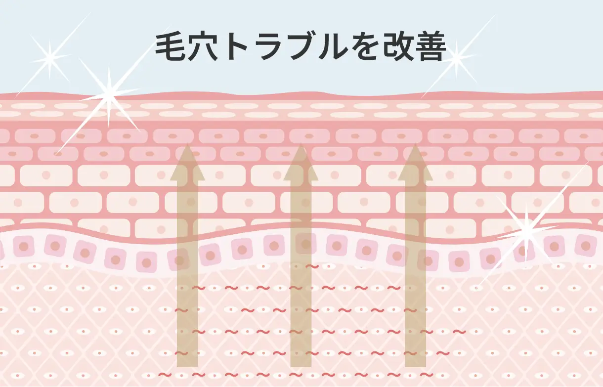 毛穴トラブルを改善