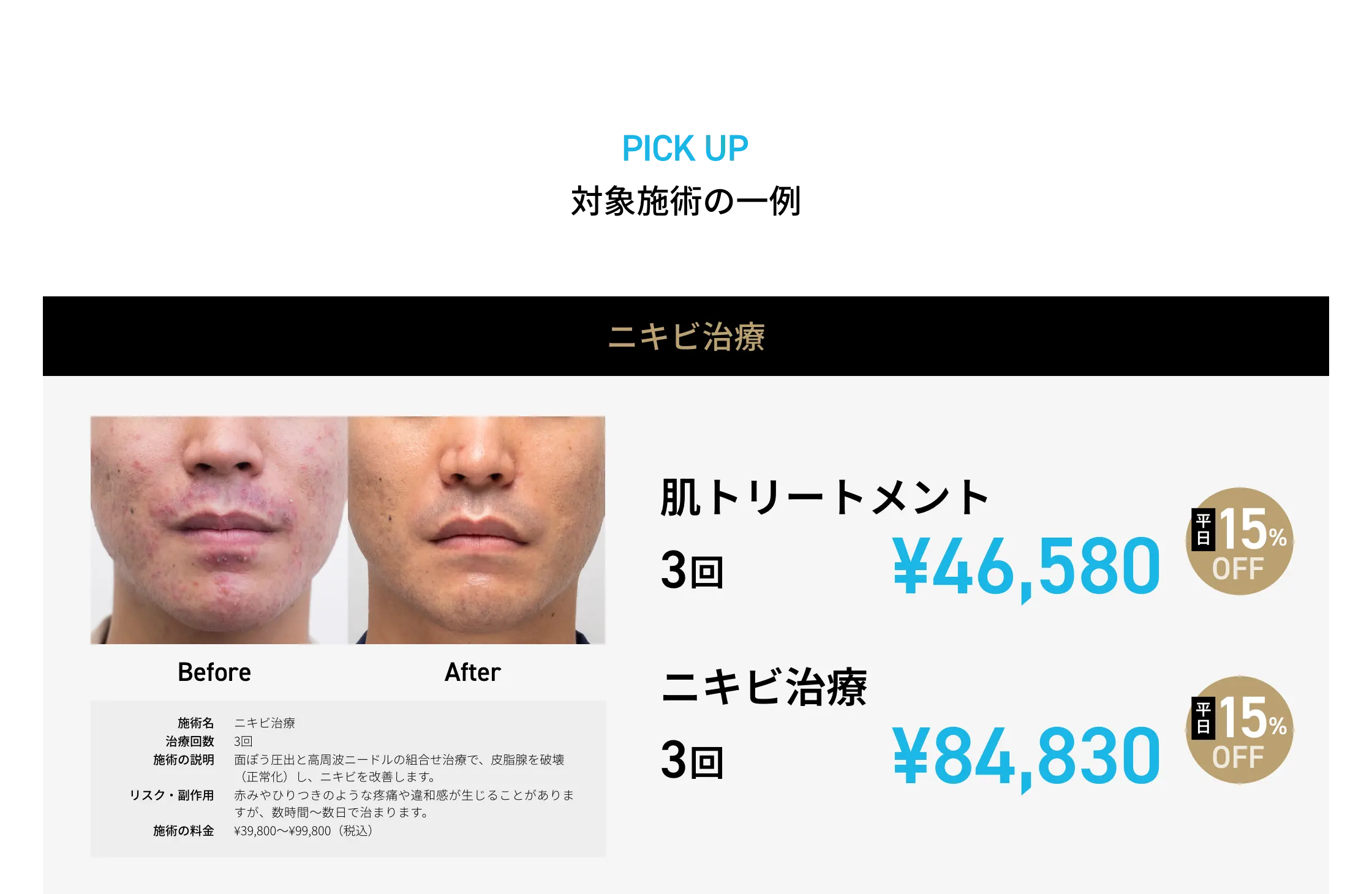 CP画像