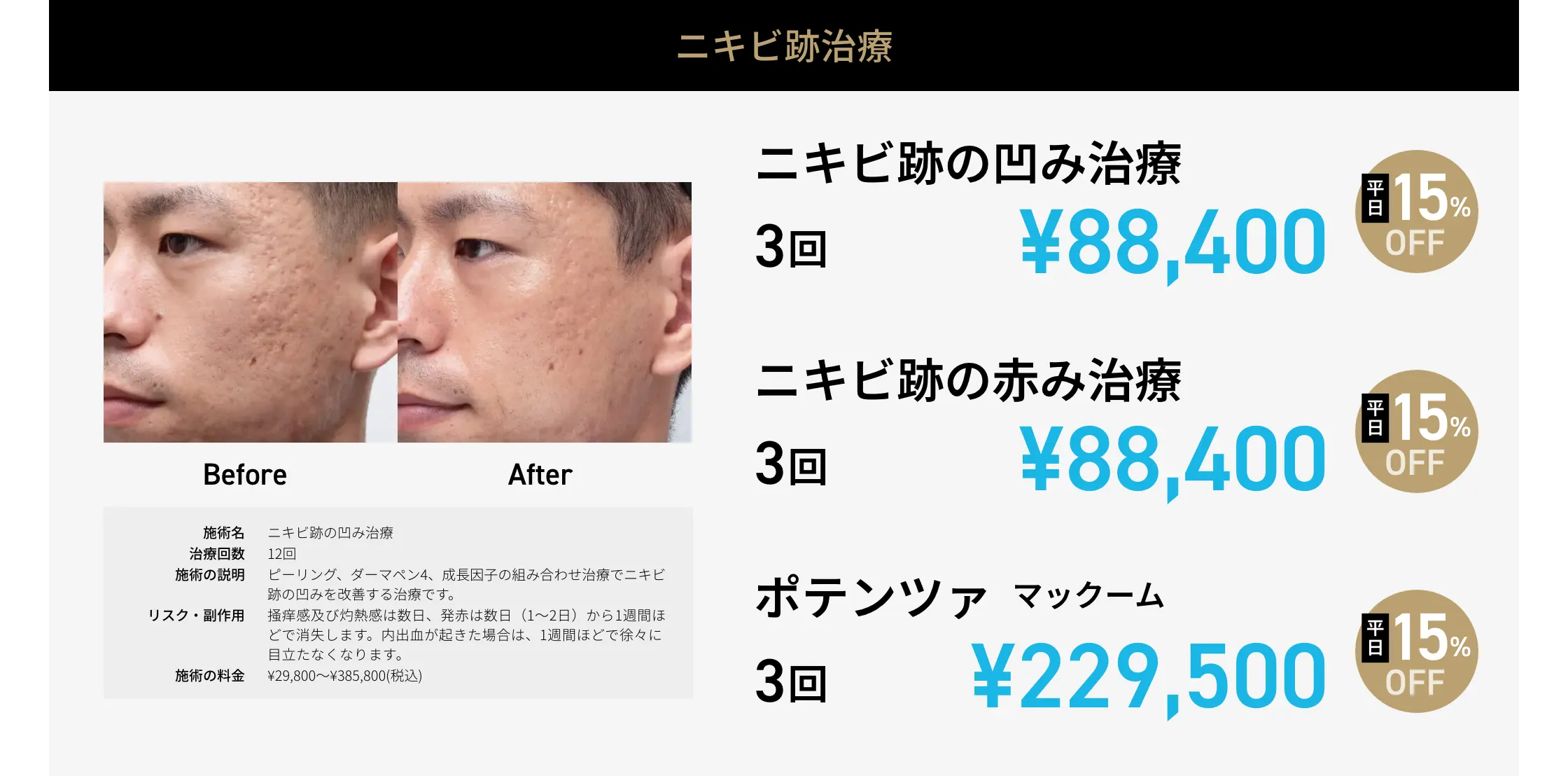 CP画像