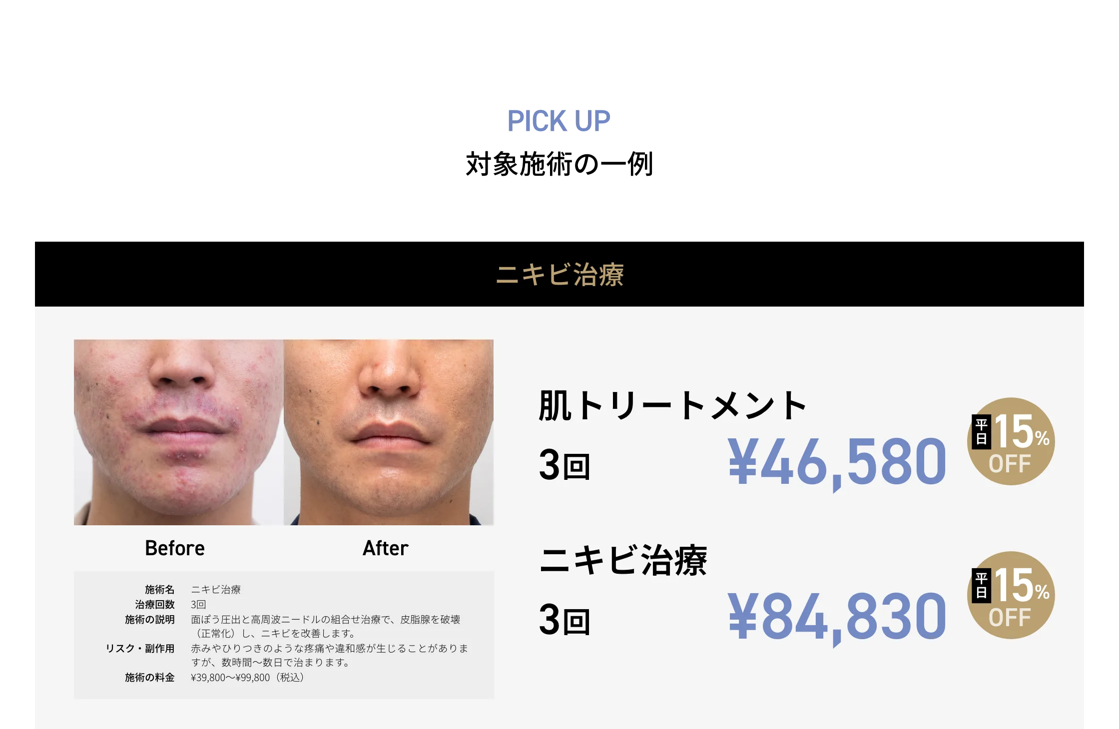 CP画像