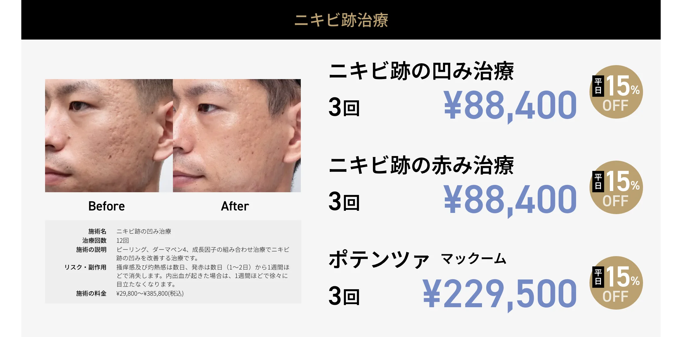 CP画像