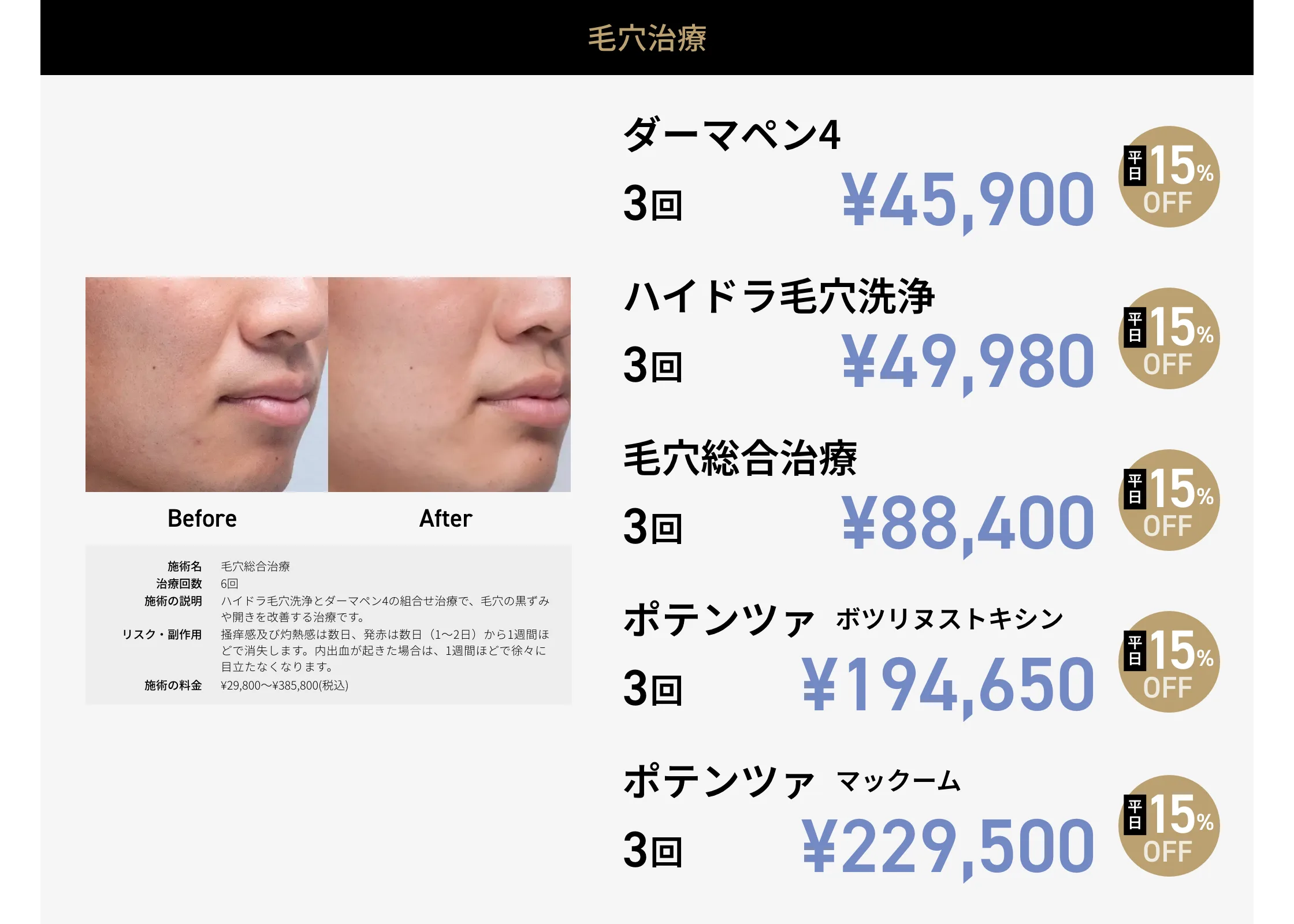 CP画像