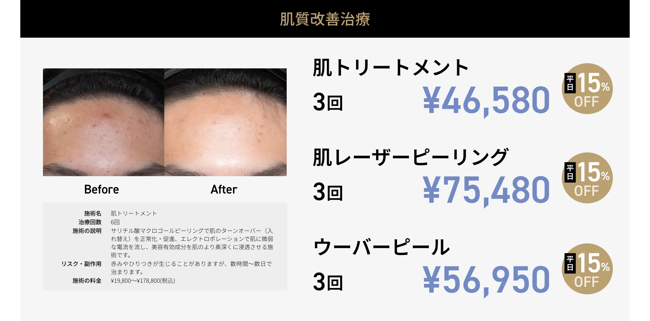 CP画像