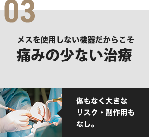 03 メスを使用しない機器だからこそ痛みの少ない治療 傷もなく大きなリスク・副作用もなし。