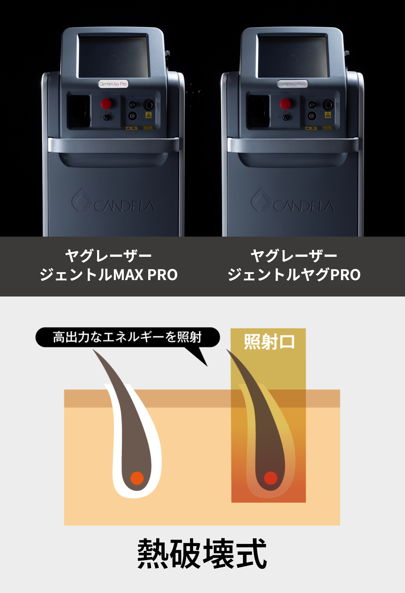 ヤグレーザージェントルMAX PRO、ヤグレーザージェントルヤグPRO、熱破壊式
