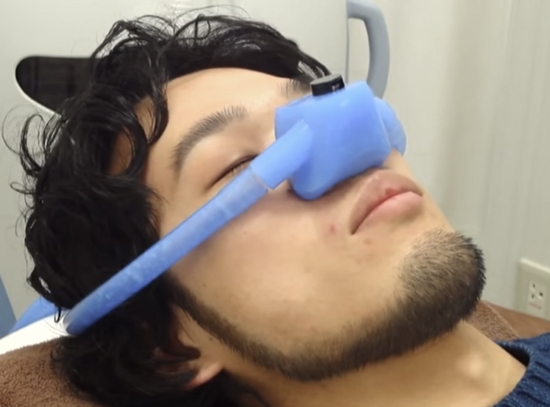 笑気麻酔