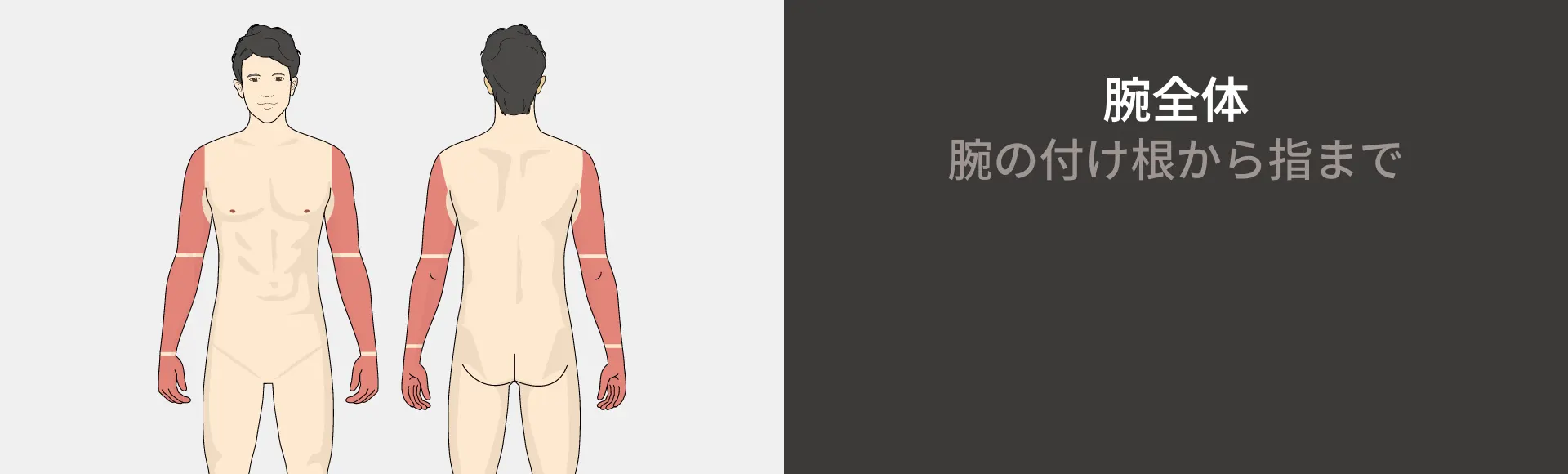 腕全体コースの医療レーザー脱毛 腕の付け根から指まで 158,800円