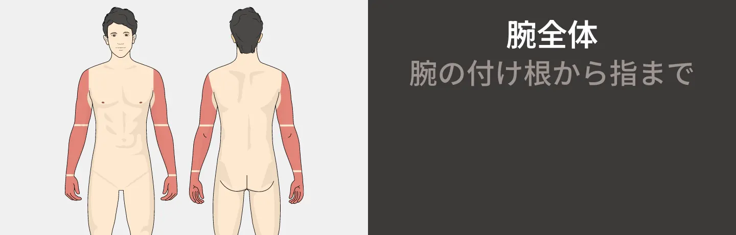 腕全体コースの医療レーザー脱毛 腕の付け根から指まで 158,800円
