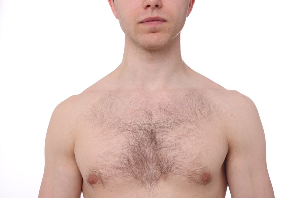 Man,Before,Hair,Removal,Procedure,On,White,Background,,Closeup