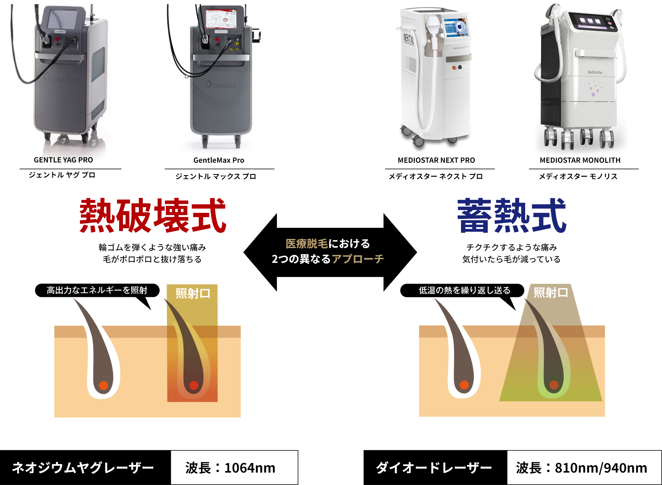 熱破壊式と蓄熱式脱毛機の違い
