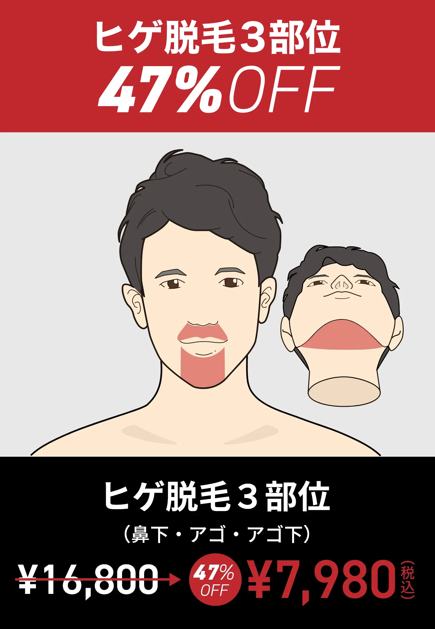 ヒゲ脱毛3部位47％OFF
