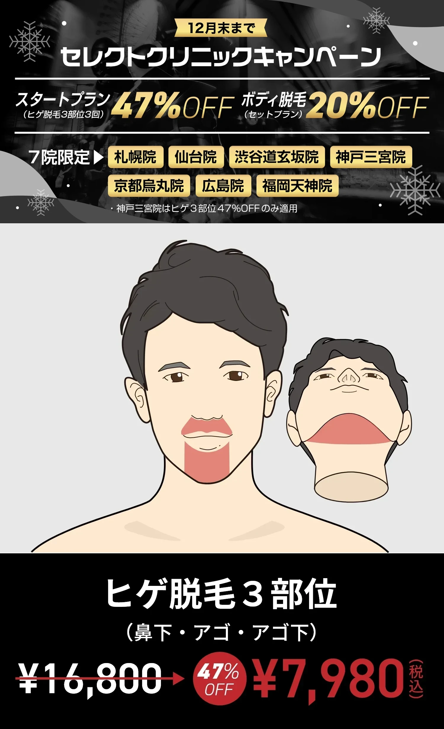 セレクトクリニックキャンペーン