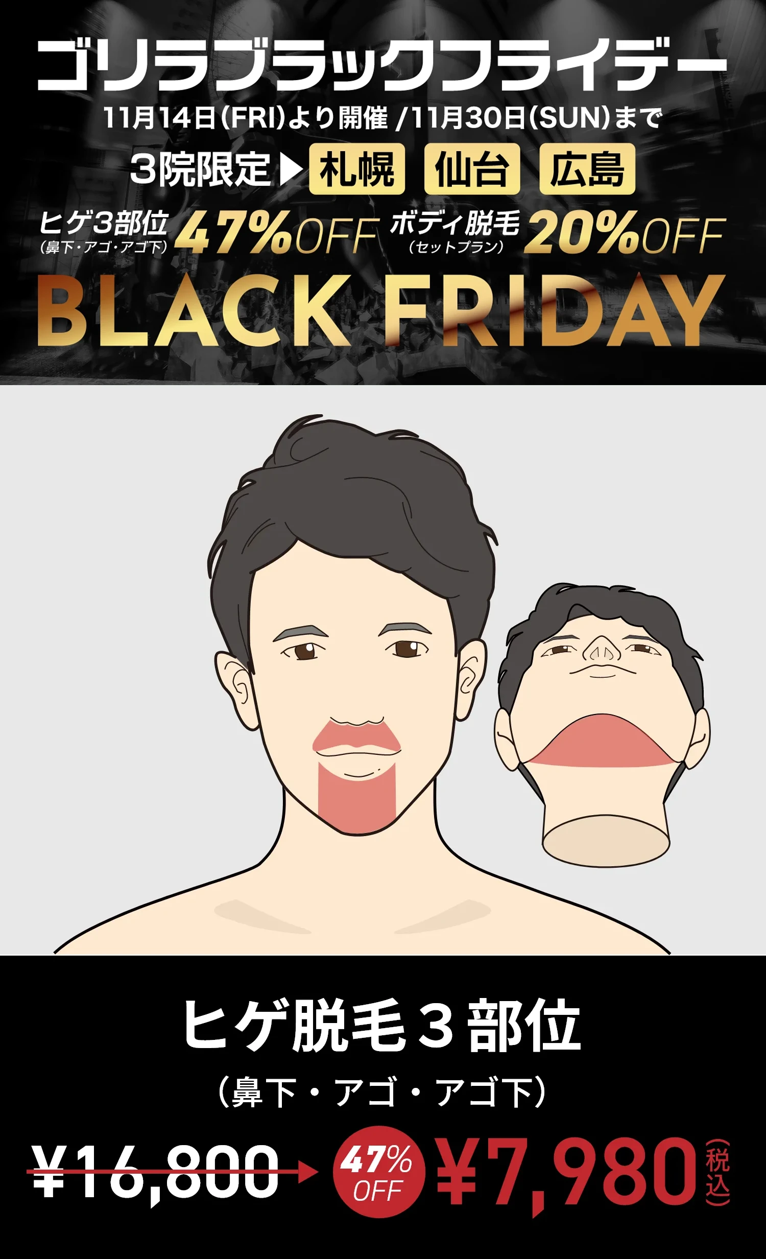 11月限定 札幌・仙台・広島 限定 ヒゲ脱毛（鼻下・アゴ・アゴ下）7,980円（税込）