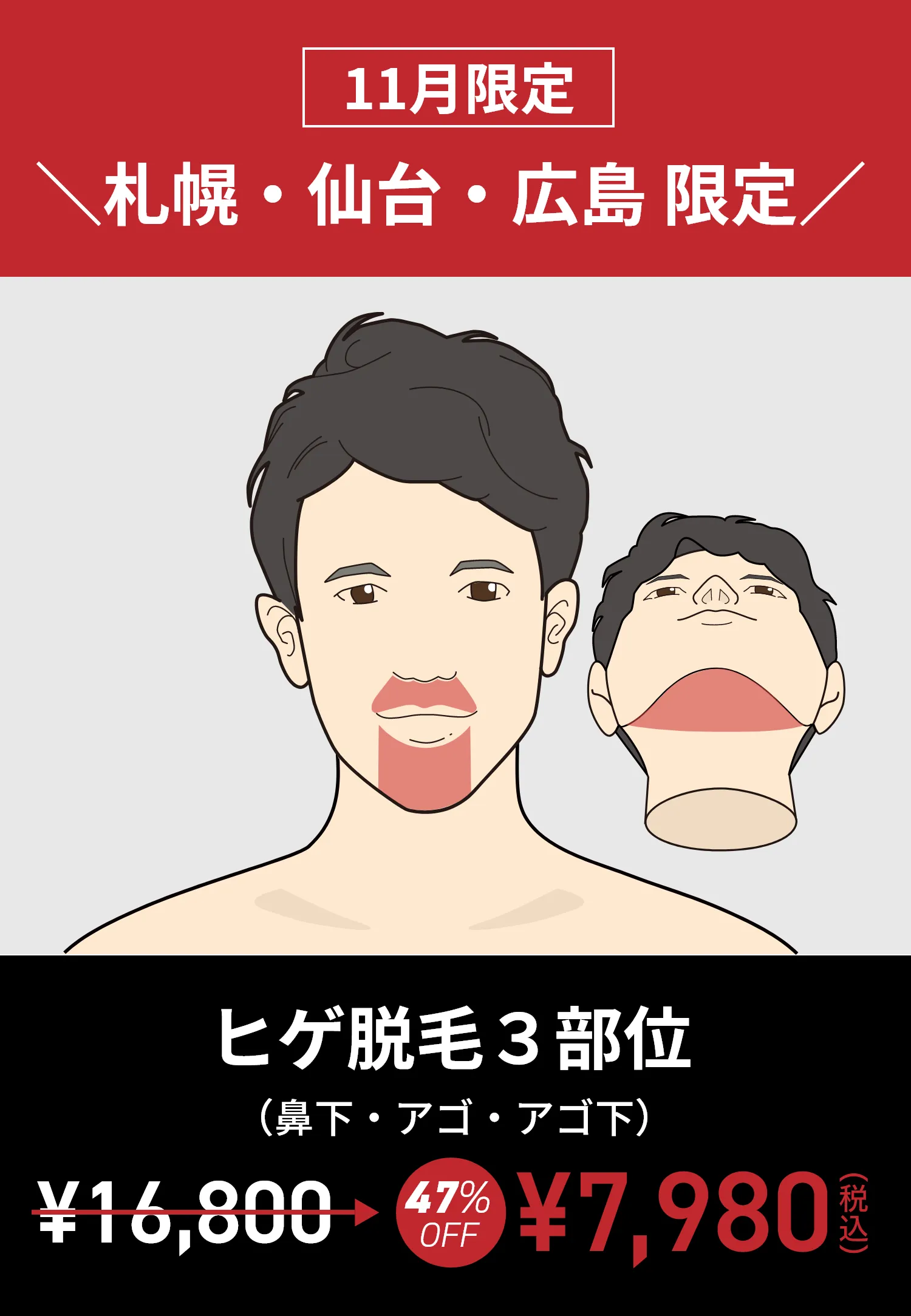 11月限定 札幌・仙台・広島 限定 ヒゲ脱毛（鼻下・アゴ・アゴ下）7,980円（税込）